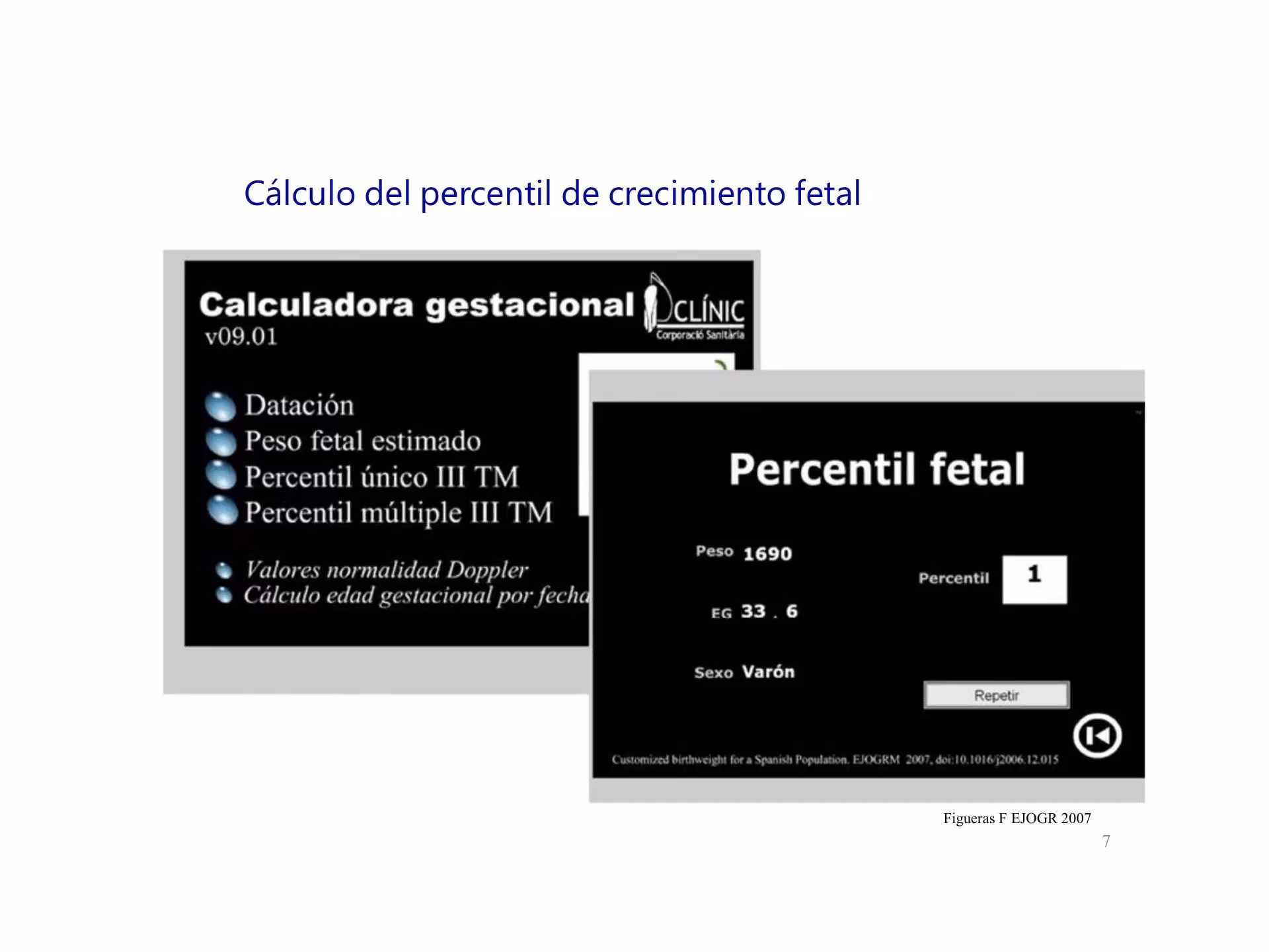 ¿Cuándo se considera un RCIU?