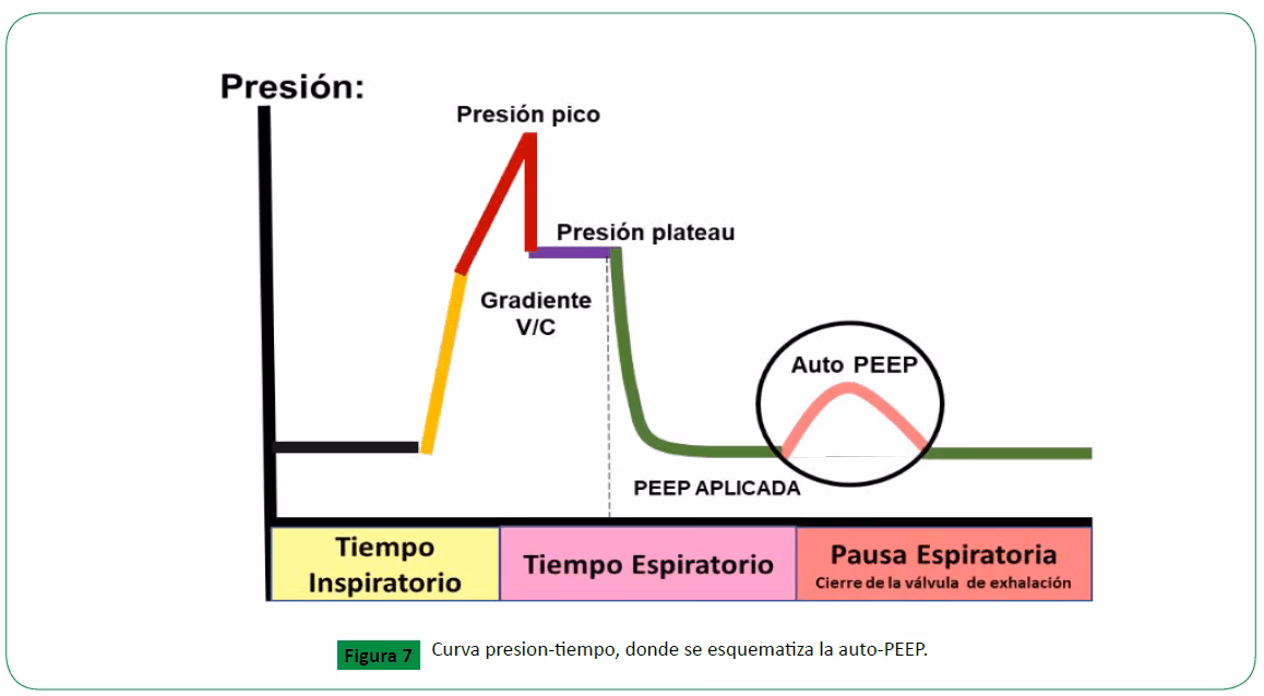 ¿Cómo se calcula el tiempo inspiratorio?