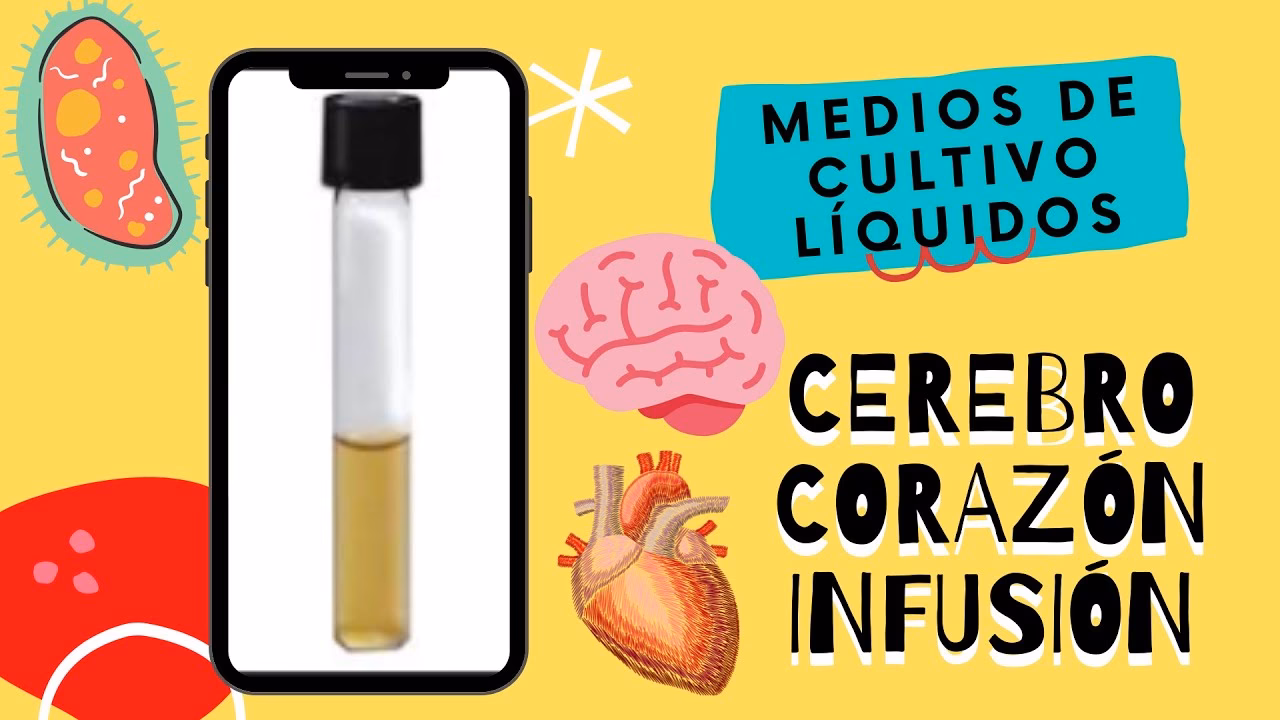 ¿Qué tipo de medio es el agar infusion cerebro corazón?
