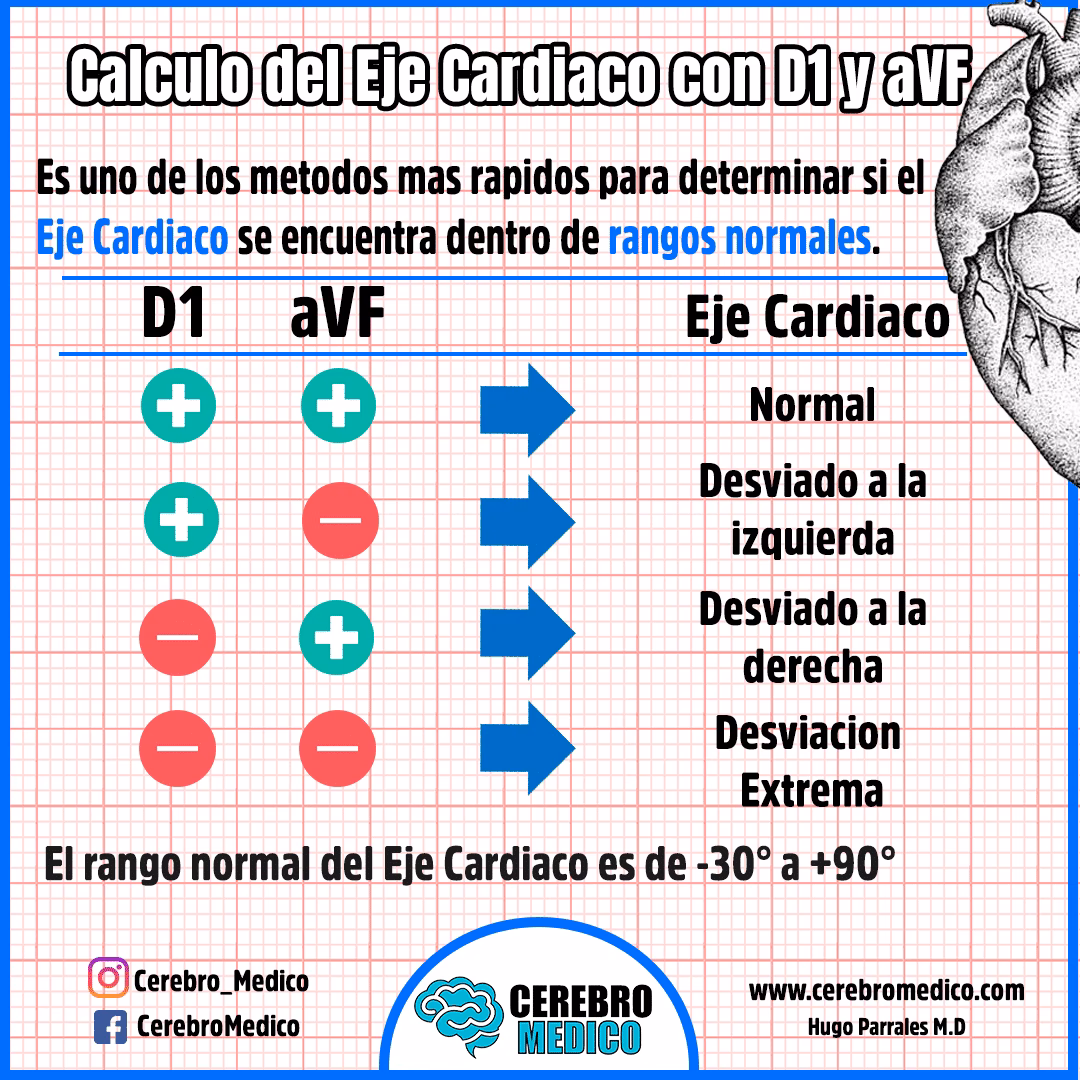 ¿Cuál es la fórmula para calcular el eje cardíaco?