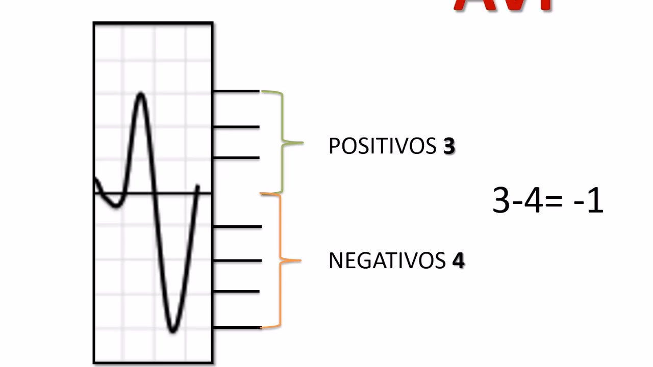 ¿Cuál es la fórmula para calcular el eje cardíaco?
