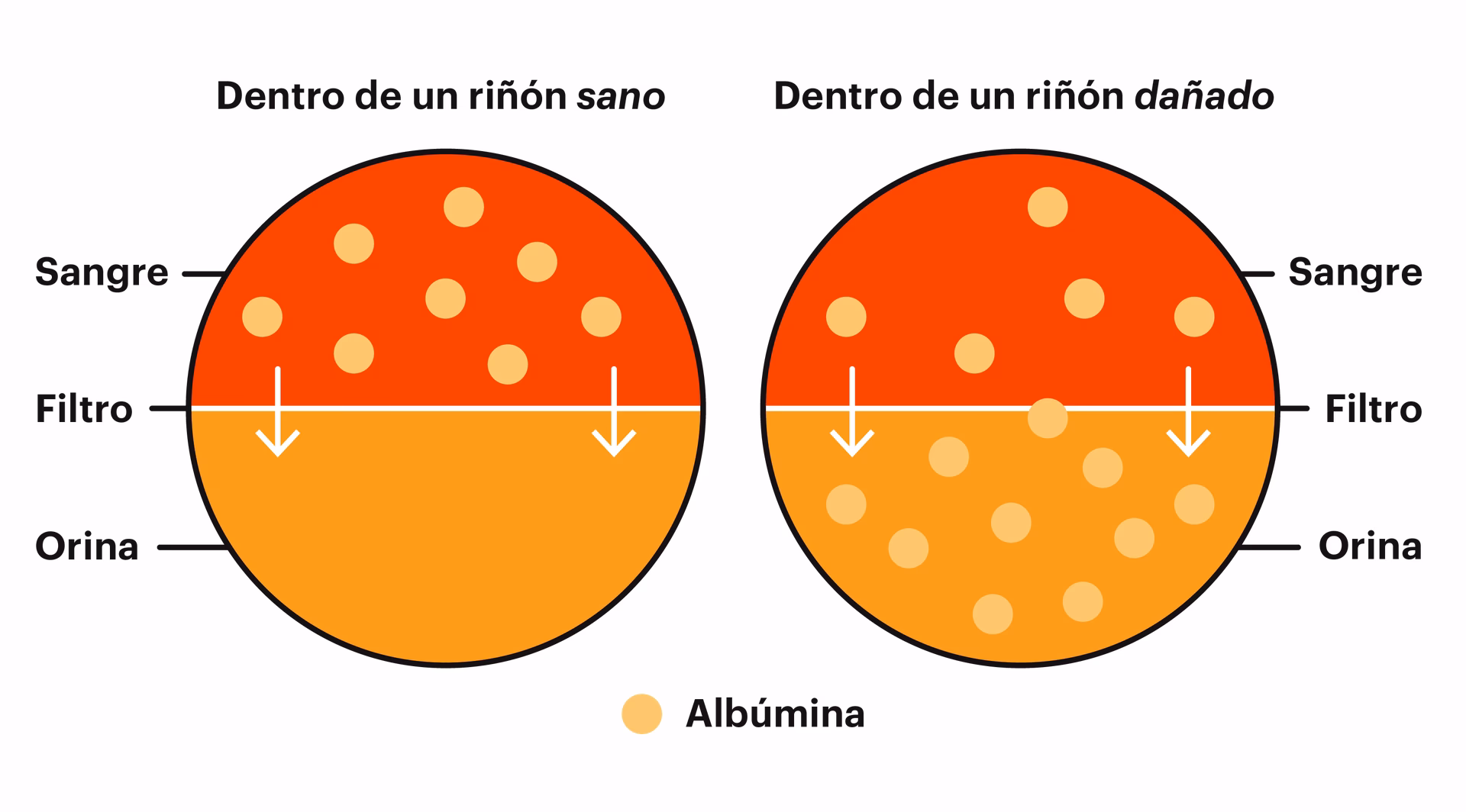 ¿Cómo se calcula la relación albúmina-creatinina?