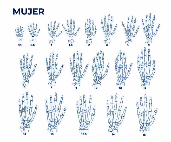 ¿Cómo se calcula la edad ósea en niños?