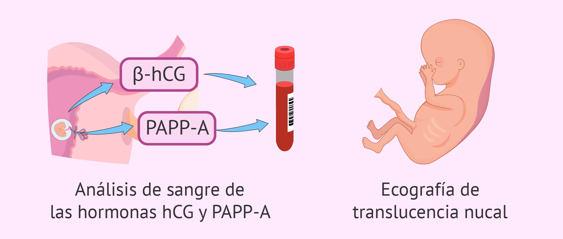 ¿Cuáles son los valores normales del triple screening?