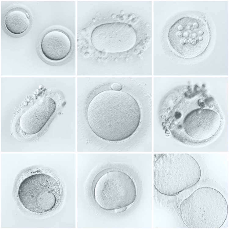¿Cómo puedo saber si mis óvulos son de buena calidad?